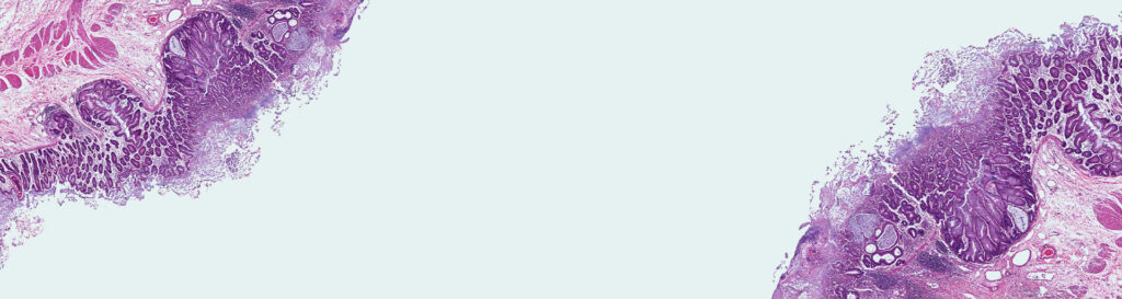 stem cells nz | Stem Cell Therapy | NZ Stem Cell Treatment Centre | stem cell treatment